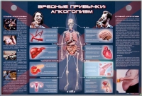 Электрифицированный стенд "Вредные привычки: алкоголизм" - «globural.ru» - Ижевск