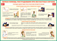 Таблица Порядок действий при опасном кровотечении 1000*1400 винил - «globural.ru» - Ижевск