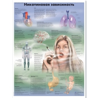 Плакат "Никотиновая зависимость", ламинированный, 50*67 см - «globural.ru» - Ижевск